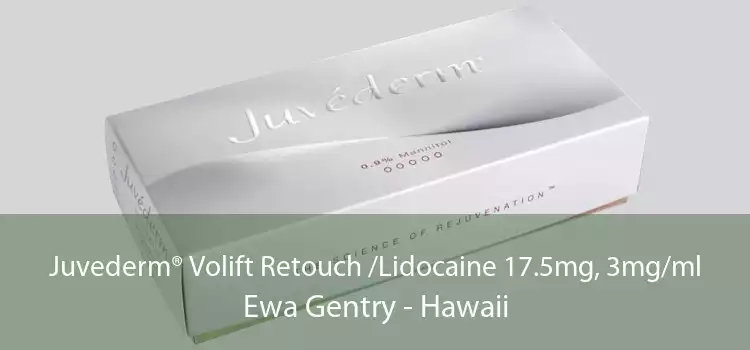 Juvederm® Volift Retouch /Lidocaine 17.5mg, 3mg/ml Ewa Gentry - Hawaii